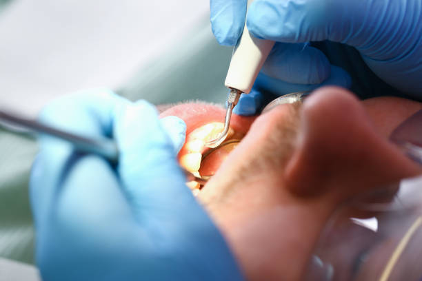 Best Pediatric Emergency Dentist in Edmundson, MO