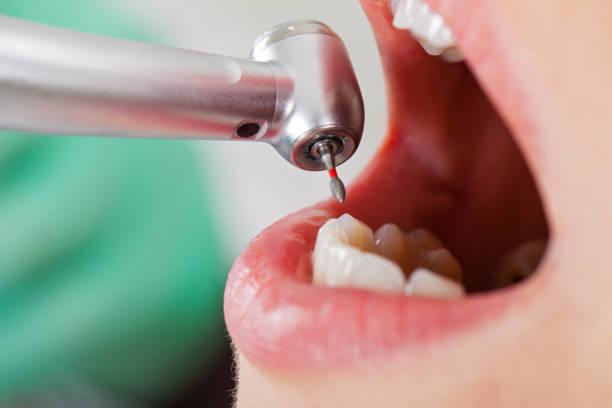 Best Broken or Cracked Tooth Emergency Dentist in Edmundson, MO